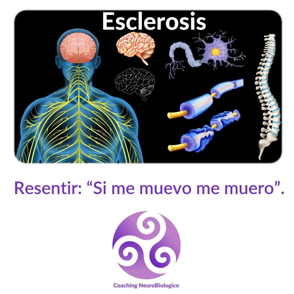 Esclerosis