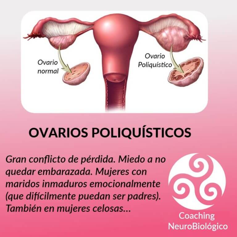 Ovario Poliquístico Coaching De Salud Integral 6463