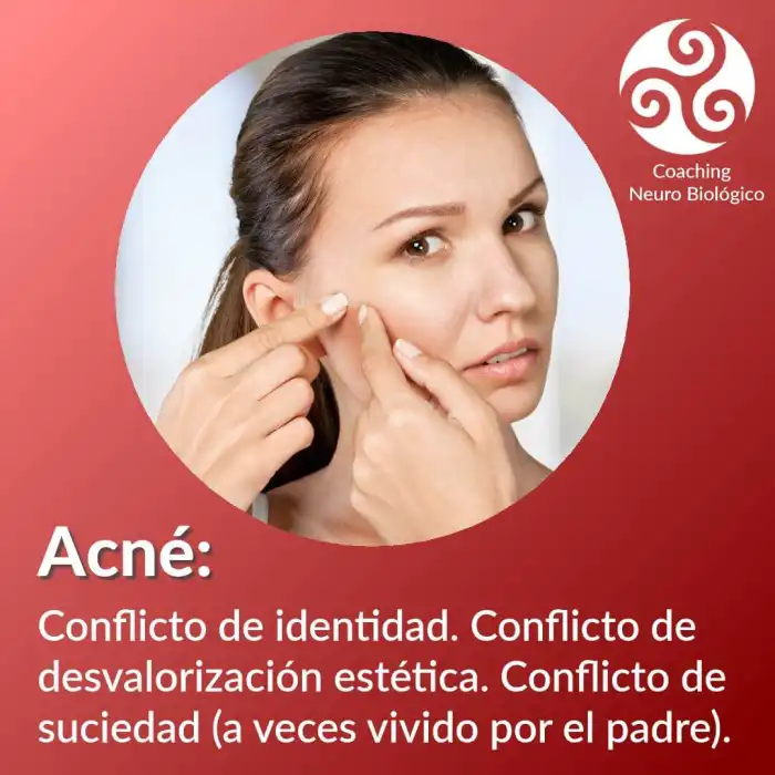 biodescodificacion-acne-piel