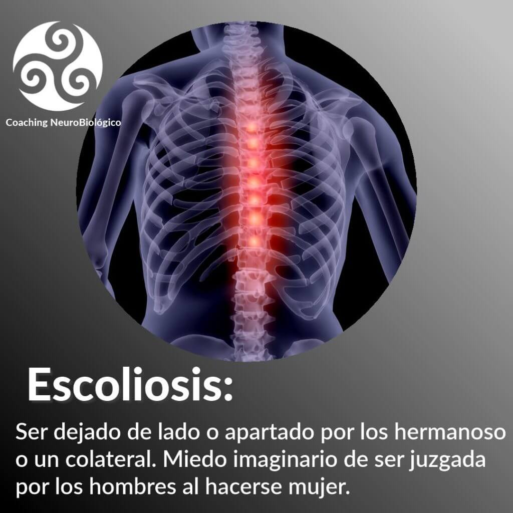 escoliosis