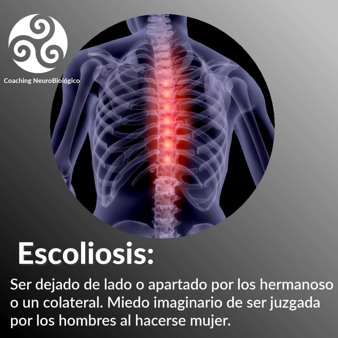 Escoliosis – Coaching de Salud Integral.