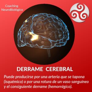 Derrame_Cerebral