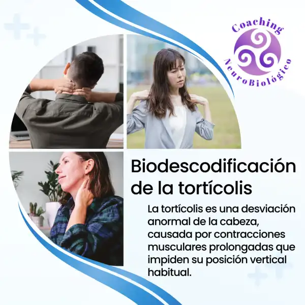 Biodescodificación de la torticolis