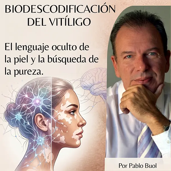 El conflicto emocional detrás del vitiligo